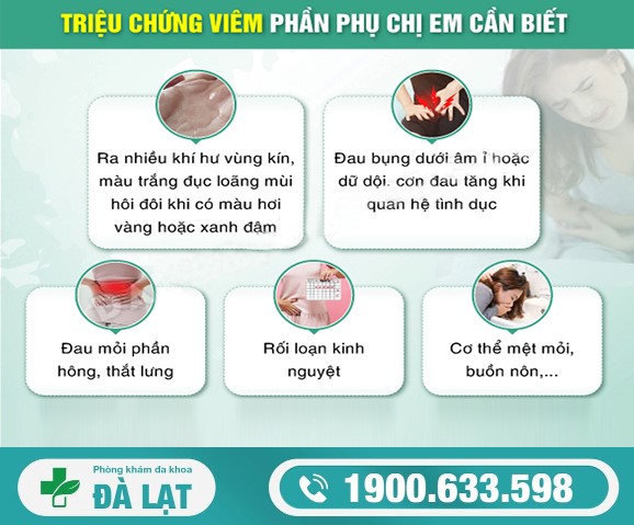 Hình ảnh minh họa